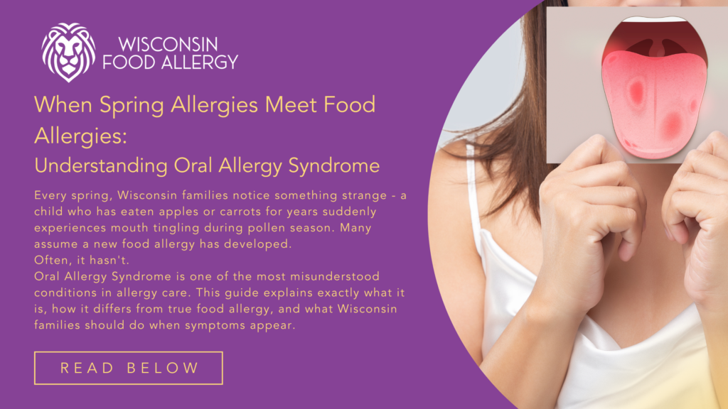 OAS vs Food Allergy - Wisconsin Food Allergy - Dr Ringwala